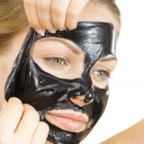 Removedor de puntos negros Mascarilla facial Chovemoar